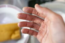 Waschmittel bei Allergien: So vermeiden Sie Hautausschläge am Hochzeitstag (Foto: AdobeStock - 649129151 wachiwit)